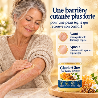 Glacielle – Baume apaisant pour peaux sujettes à l'eczéma et au psoriasis